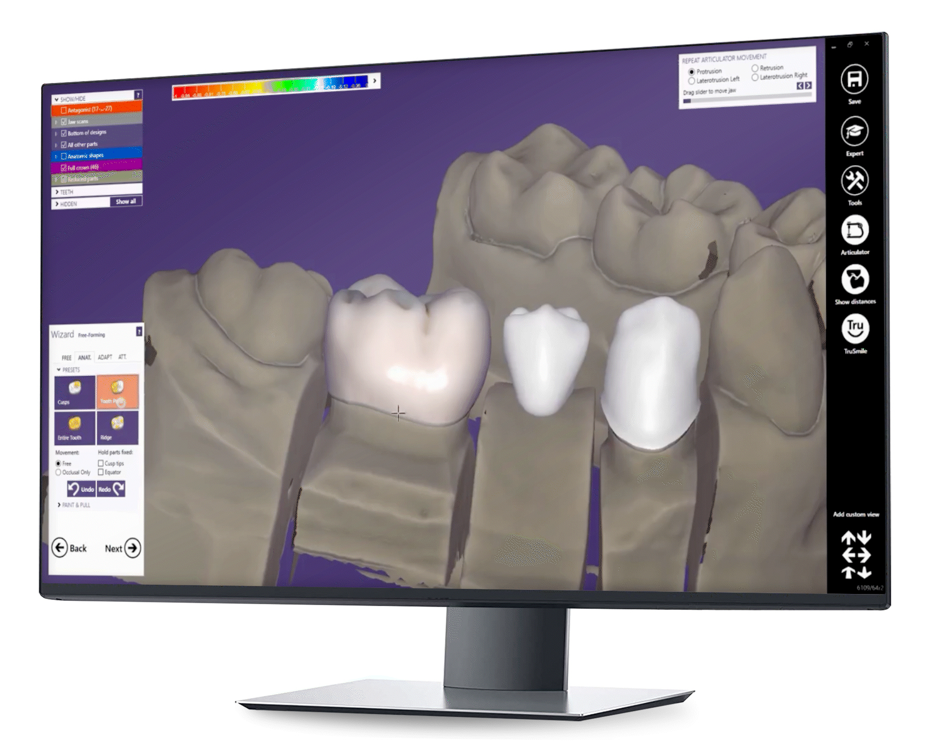 Exocad_Screen