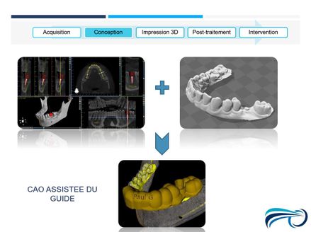 Odoo - Echantillon n°1 pour trois colonnes 