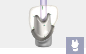 Exocad Module Implant - perpetuel