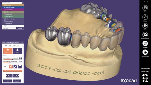 [EXO-DCAD-IMP-FLEX-Y1] Exocad DentalCAD pack Implant - abonnement annuel