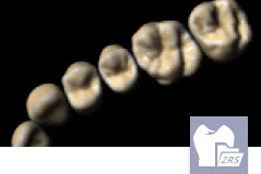 [EXO-ADDON-ZRS-PERP] Exocad Module Librairie de Dents - perpetuel